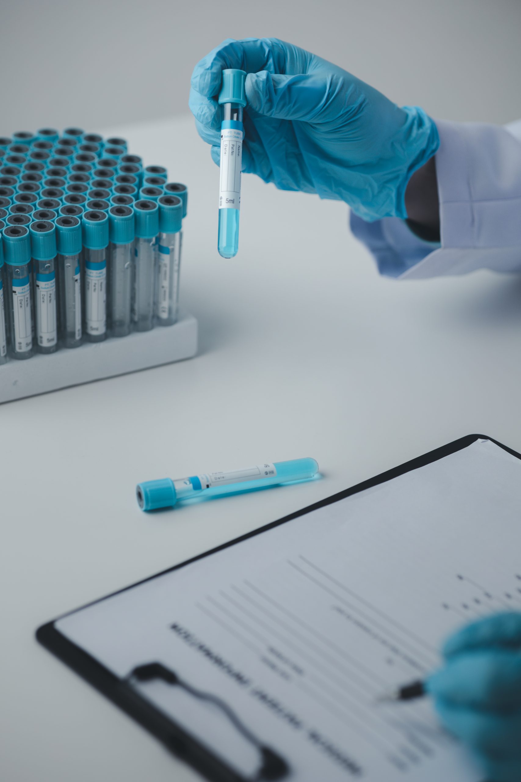 Lab assistant, a medical scientist, a chemistry researcher holds a glass tube through the blood sample, does a chemical experiment and examines a patient's blood sample. Medicine and research concept.